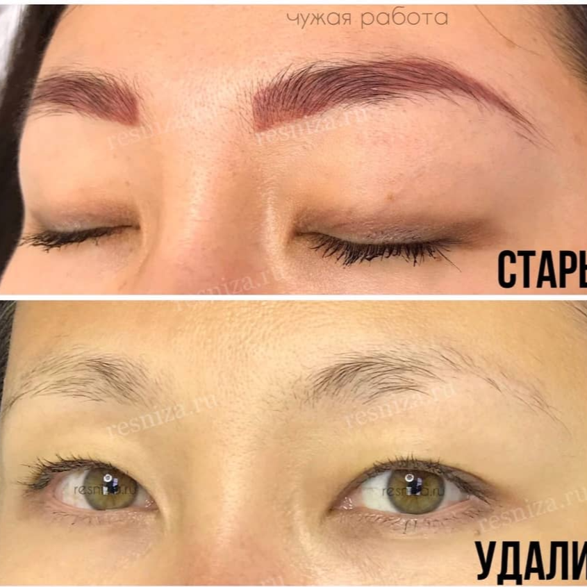 <a href="https://vuberi.ru/style/" rel="noopener noreferrer" target="_blank">УДАЛЕНИЕ ТАТУАЖА</a>